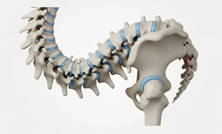 Escoliose pode matar